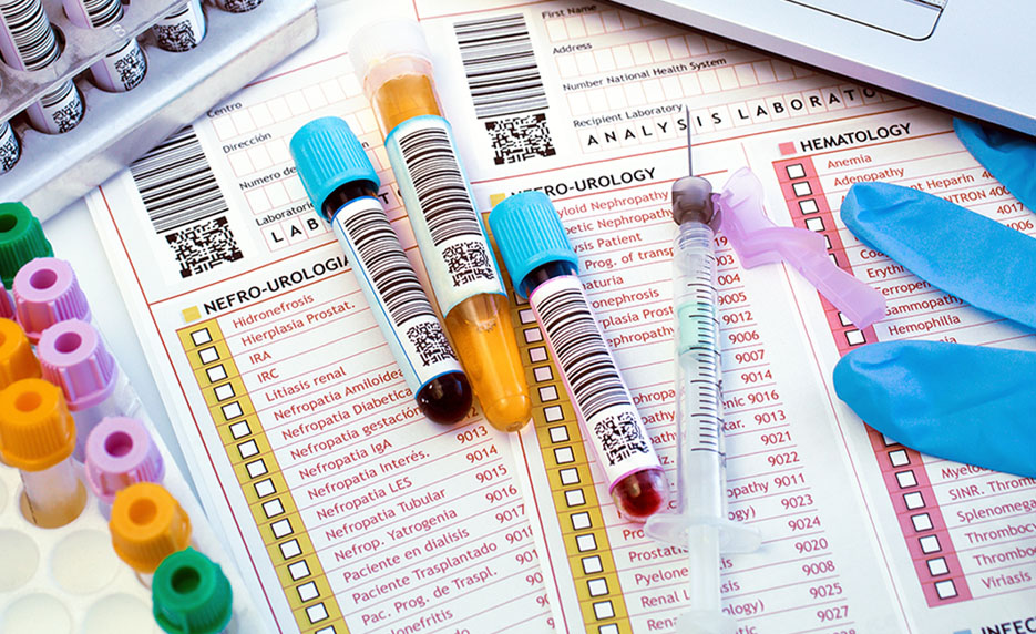 Test tubes and syringes on lab forms, next to blue gloves and laptop keyboard.
