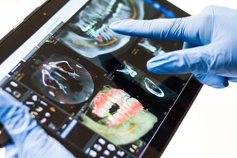 Dental X-Ray Diagnosis on a tablet