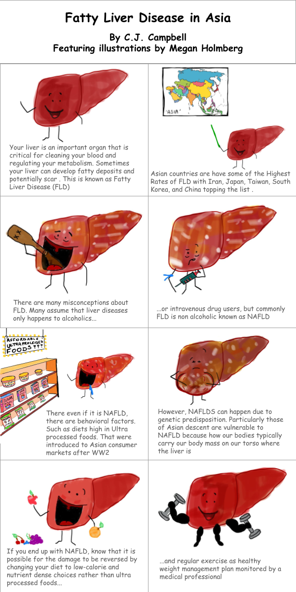 Illustrated comic explaining fatty liver disease in Asia, including causes, risks, diet, genetics and prevention tips.