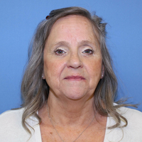 Lori Benedict